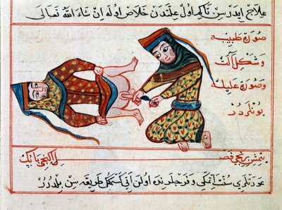 Medicina: operación de un hermafrodita. Miniatura de un tratado de medicina turca por Sharaf al-din de Ottoman School