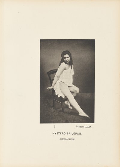 Contractura histeroepiléptica de Paul Marie Léon Regnard