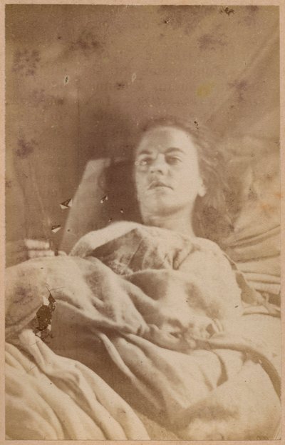 Epilepsia histérica, ataque, tercer período, lámina XXVI de 