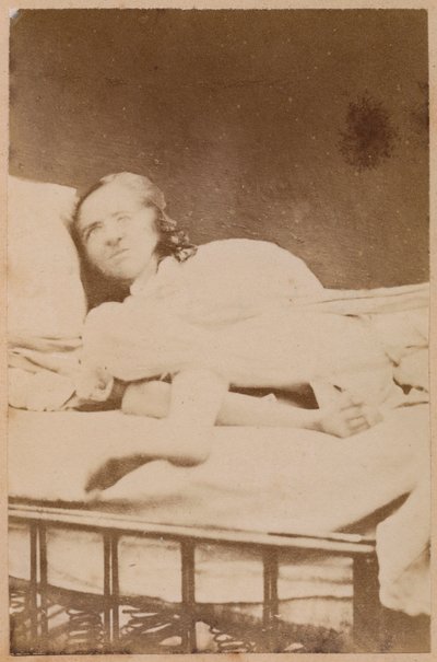 Epilepsia histérica, contorsiones, lámina XXXVIII de 