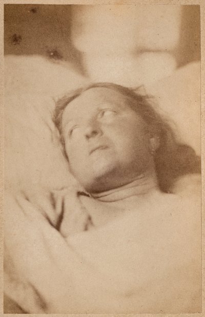 Epilepsia histérica, crucifixión, actitud de la cabeza, placa VII de 