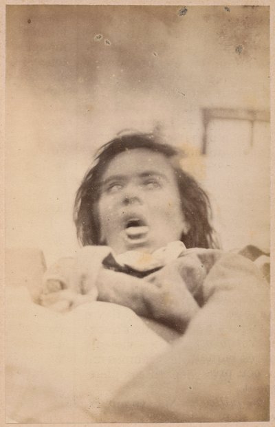 Epilepsia histérica, alucinaciones, angustia, lámina XXIX de 