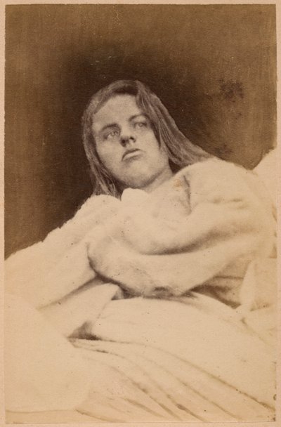 Epilepsia histérica, alucinaciones, desdén, lámina XXXI de 