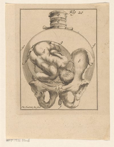 Feto en el útero
Impresiones médicas sobre el embarazo y el parto (título de la serie) de Philibert Bouttats (II)