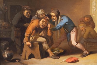 La operación de la piedra de Pieter Jansz. Quast