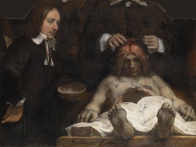 La lección de anatomía del Dr. Jan Deyman, 1656 de Rembrandt van Rijn
