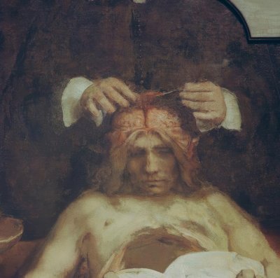 La anatomía del Dr. Johan Deijman de Rembrandt van Rijn