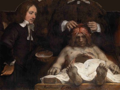 La lección de anatomía del Dr. Jan Deijman, 1656 de Rembrandt van Rijn
