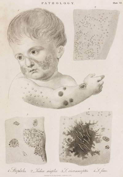 Dermatología Tipos de enfermedades de la piel de John Pardon