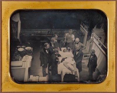Uso de éter para anestesia de Southworth and Hawes