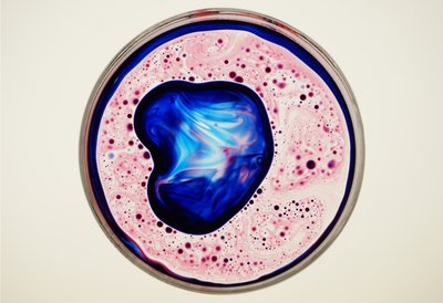 Placa de Petri, 2024 de Steve Pavlovsky
