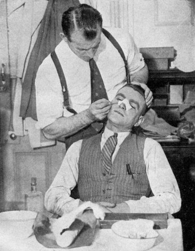 El capitán de Inglaterra Eddie Hapgood recibe tratamiento por una nariz rota después de un partido con Italia, 1934. de Topical Press Agency