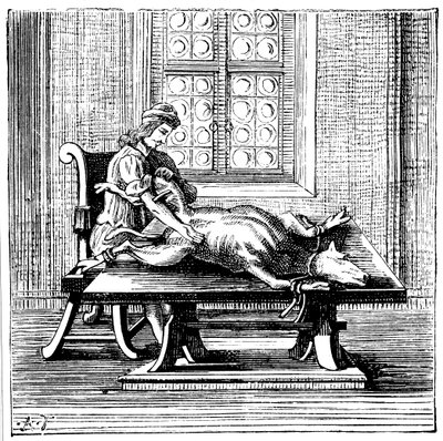 Transfusión de sangre de animal a humano, 1679 de Unbekannt