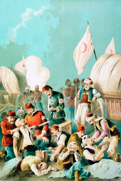 Amputación de un brazo sin anestesia, Guerra Ruso-Turca, 1877 de Unbekannt
