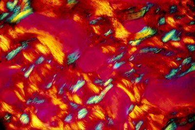 Biomateriales, LM hueso de Unbekannt