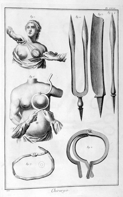 Cirugía de mama, 1751-1777 de Unbekannt