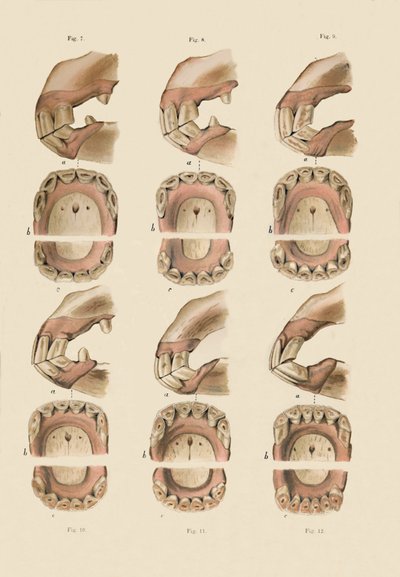 Descripción de la placa que muestra la edad, según lo indicado por los dientes, c1879 de Unbekannt