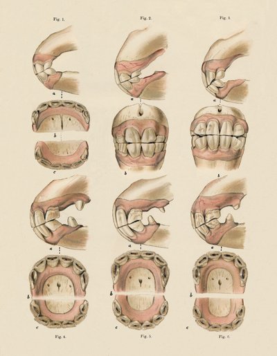 Descripción de la placa que muestra la edad, según lo indicado por los dientes, c1879 de Unbekannt