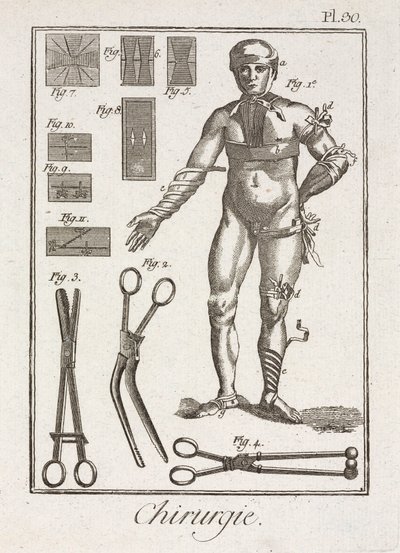 Equipamiento, vendaje de una figura humana de la Edad Moderna de Unbekannt
