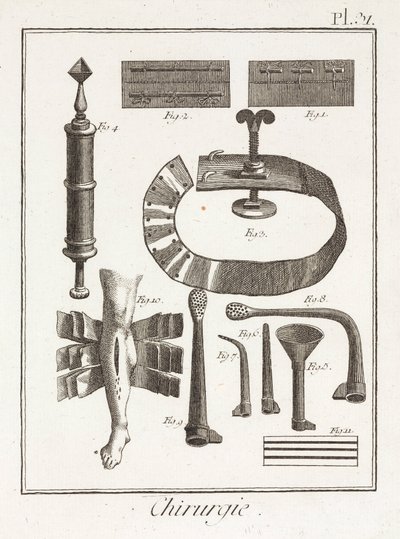 Equipamiento, dispositivos quirúrgicos de la Edad Moderna de Unbekannt