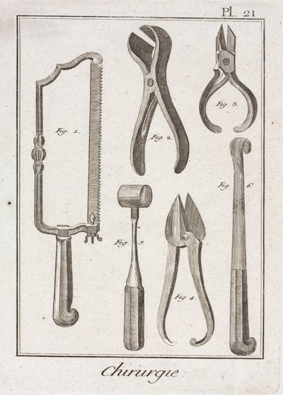 Equipamiento, sierra quirúrgica y otros instrumentos de la era moderna temprana de Unbekannt