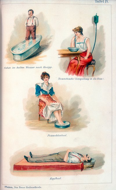 Tratamientos de hidroterapia, c. 1902 de Unbekannt