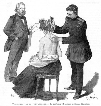 El profesor Bergmann inyectando a un paciente de tuberculosis, 1891 de Unbekannt