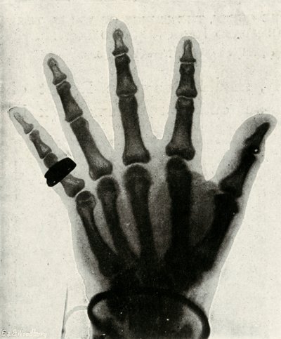 Radiografía de la mano de S.A.R. El Príncipe de Gales, c. 1897 de Unbekannt