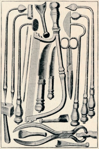 Instrumentos quirúrgicos, 1639 de Unbekannt