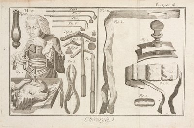 Trepanación de Unbekannt