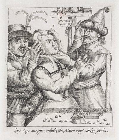 Trepanación ïExtracción de la piedra, grabado de Unbekannt