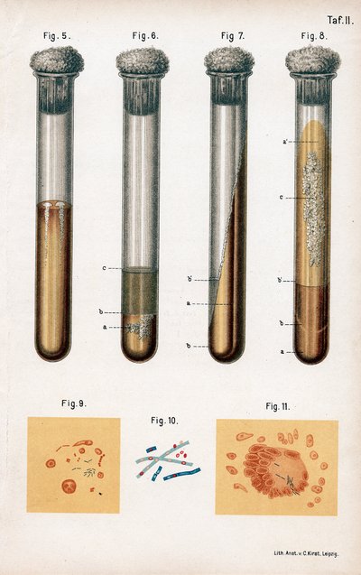 Varios tipos de bacterias, 1889 de Unbekannt