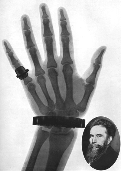 Radiografía de una mano, 1926 de Unbekannt