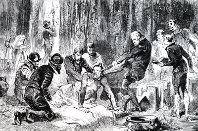 Ambroise Paré removiendo una lanza del rostro del Duque de Guisa de Unbekannt