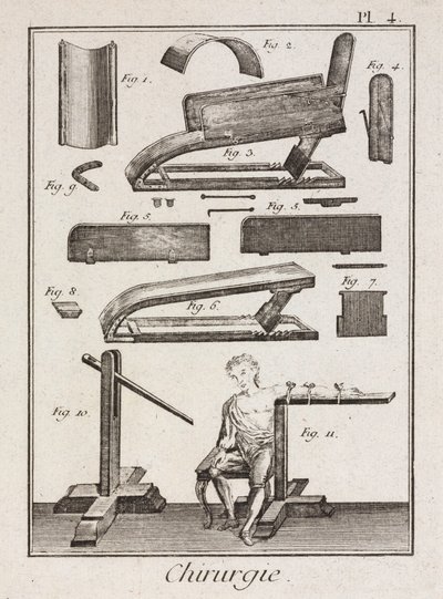 Equipamiento, Instrumentos de sangría de la Edad Moderna de Unbekannt
