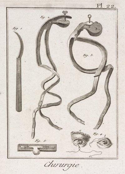 Equipamiento, Cirugía ocular de la Edad Moderna de Unbekannt