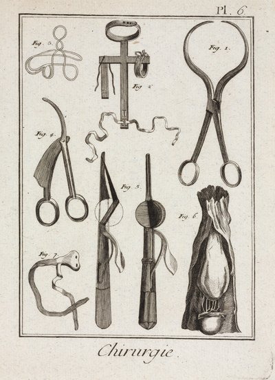 Equipamiento, Instrumentos quirúrgicos de la Edad Moderna de Unbekannt