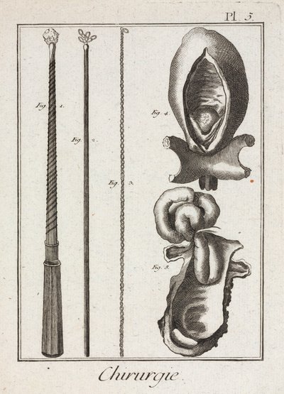 Equipamiento, Instrumentos quirúrgicos de la Edad Moderna y diagramas de partes del cuerpo de Unbekannt