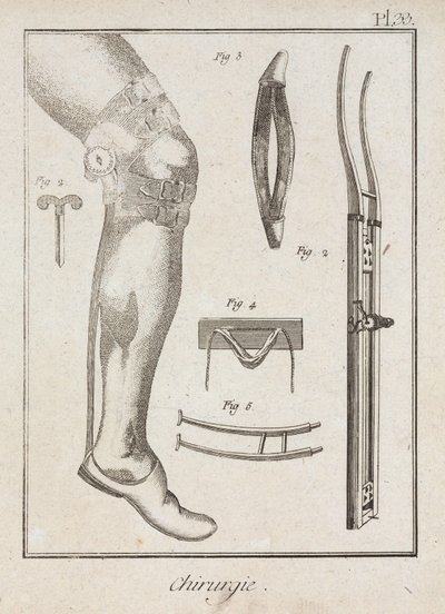 Equipamiento, Soportes quirúrgicos de la Edad Moderna de Unbekannt