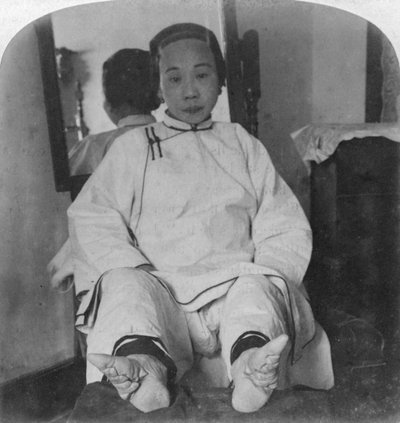Los delicados pies de una dama de alta casta, mostrando el método de deformidad, China, 1900 de Underwood and Underwood