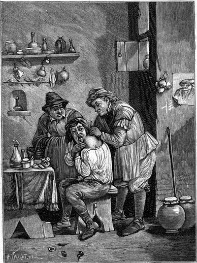 Un cirujano charlatán en el siglo XVIII examinando una lesión en el hombro. Grabado en “La Nature: revue des sciences et de leurs applications aux arts et a l