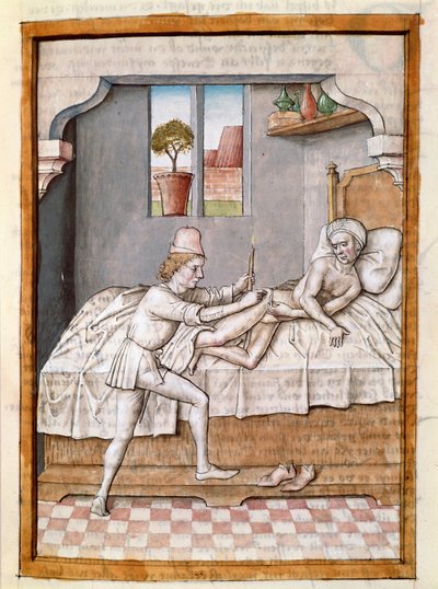 Un doctor trata a un paciente. Miniatura de una traducción alemana de las fábulas de 