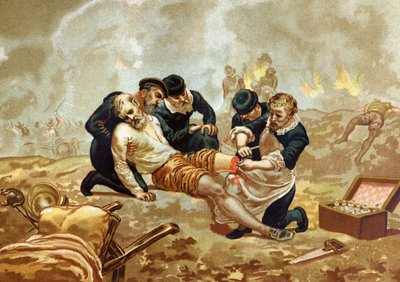 Ambroise Paré, médico y cirujano francés (c. 1509-1590) practica la ligadura de arterias después de la amputación. De Hombres y Mujeres Célebres. Barcelona 1877 de Unknown artist