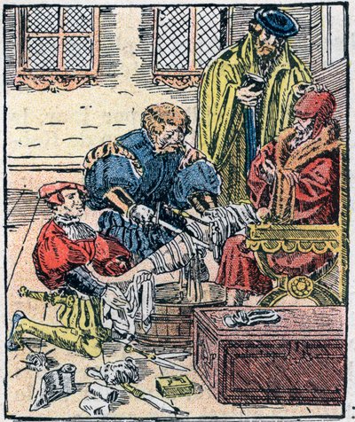 Amputación de una pierna en el siglo XVI. de Unknown artist