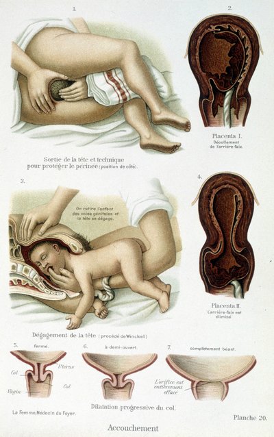 Parto - lámina científica, finales del siglo XIX de Unknown artist