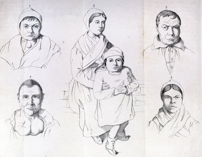 Consideraciones sobre las causas del cretinismo endémico por Morel. de Unknown artist