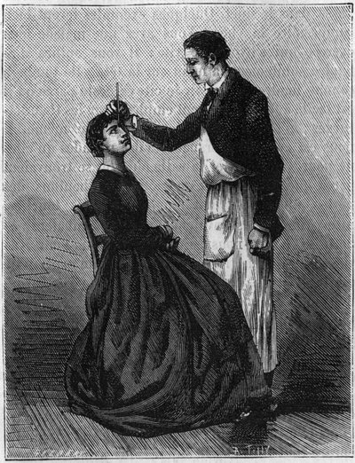 Fenómenos de hipnotismo: Hipnotismo producido al fijar un portaplumas colocado entre los ojos. Grabado de 1881 de Unknown artist