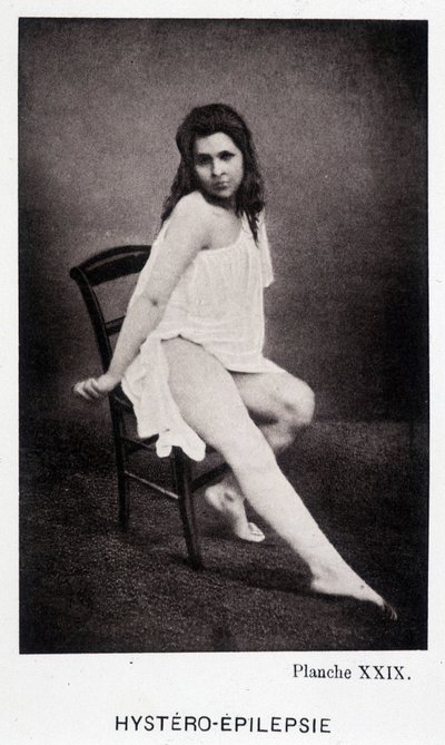 Hystero Epilepsie - Contractura en "Iconografía fotográfica de la Salpêtrière: servicio del Sr. Charcot" por Paul Regnard y Bourneville de Unknown artist