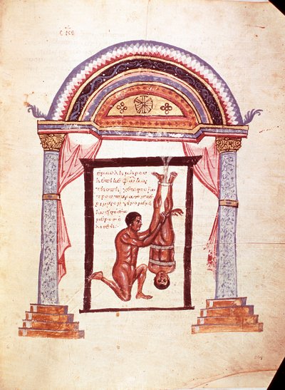 Medicina: reducción de una rodilla dislocada, el paciente está suspendido por los pies (manuscrito) de Unknown artist