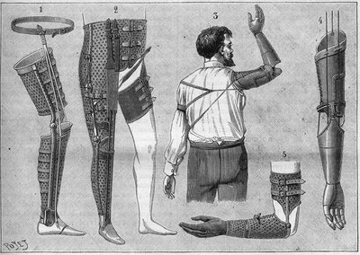 Aparatos modernos para amputados. 1) pierna artificial con cinturón, 2) aparato para desarticular el muslo, 3 y 4 brazos artificiales inventados y construidos por M.L Matthieu para el difunto Roger, 5) brazo artificial con mano, pulgar e índice. en "La nat de Unknown artist
